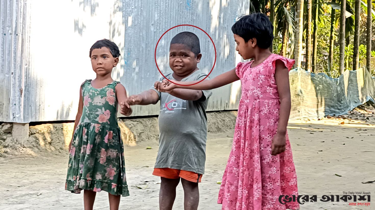 বয়স ৩২ হলেও শিশুই রয়ে গেছেন ছমির